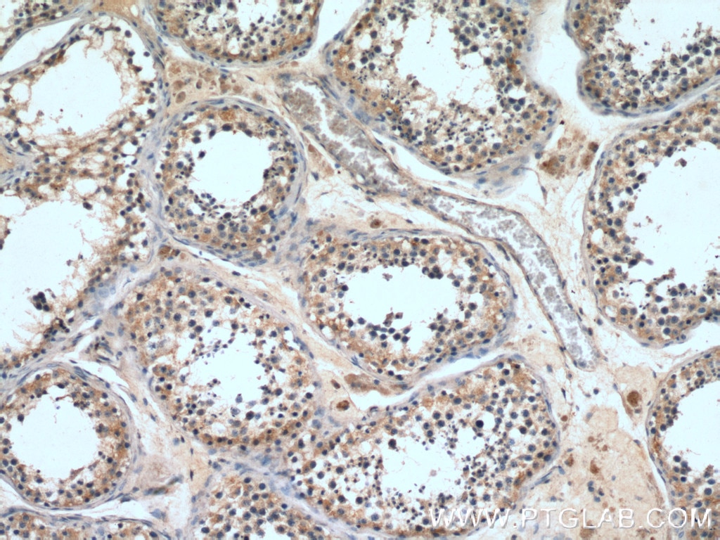 Immunohistochemistry (IHC) staining of human testis tissue using DMXL2 Polyclonal antibody (27123-1-AP)