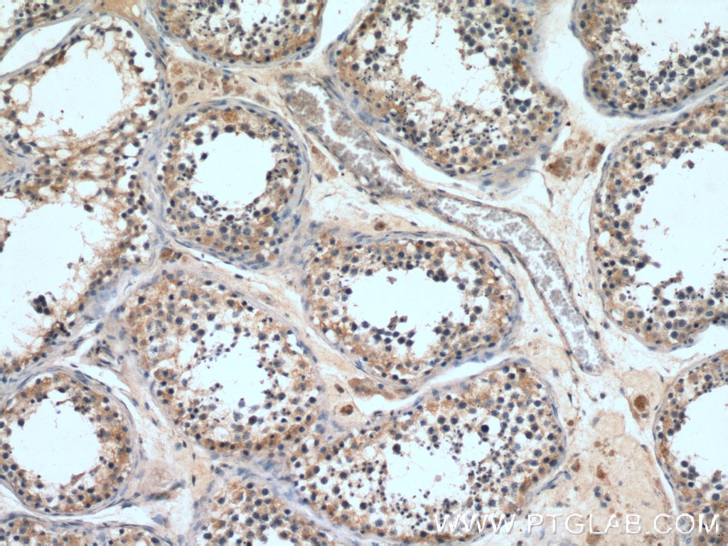 Immunohistochemistry (IHC) staining of human testis tissue using DMXL2 Polyclonal antibody (27123-1-AP)