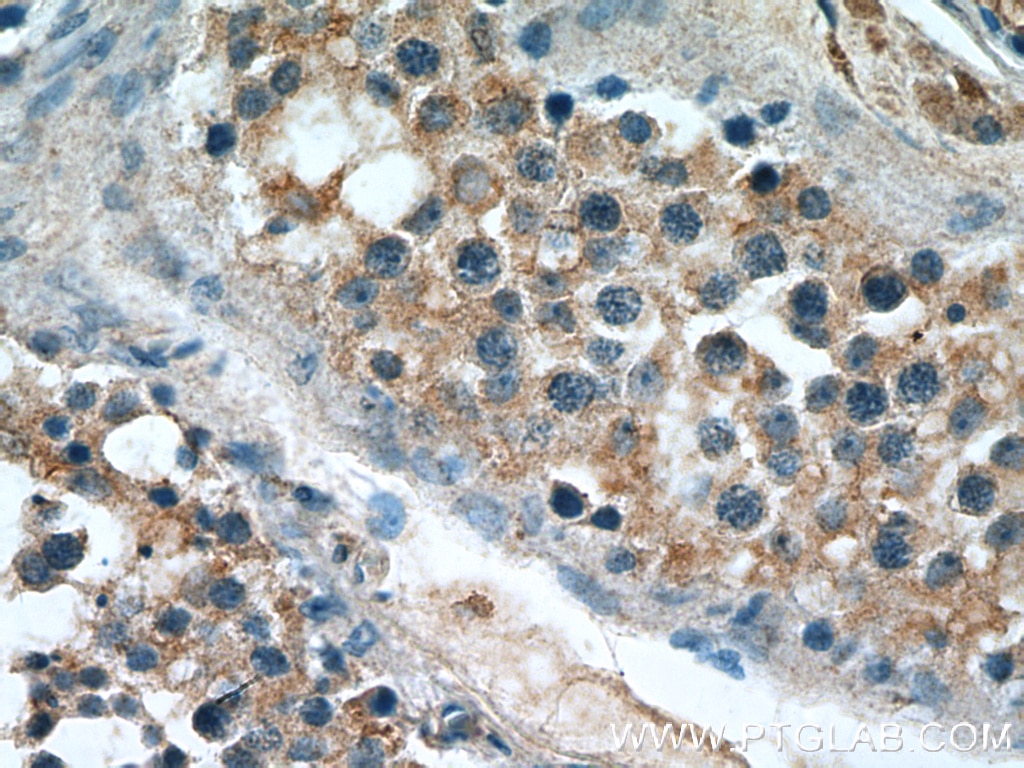 Immunohistochemistry (IHC) staining of human testis tissue using DMXL2 Polyclonal antibody (27123-1-AP)