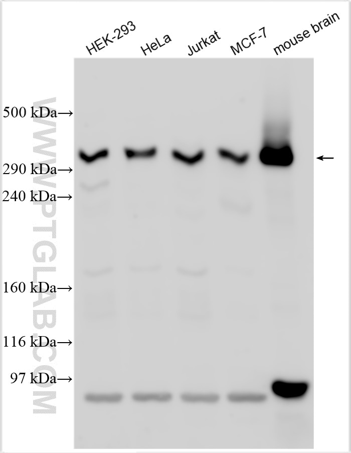 Western Blot (WB) analysis of various lysates using DMXL2 Polyclonal antibody (27123-1-AP)