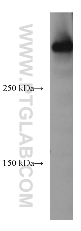 Western Blot (WB) analysis of Jurkat cells using DMXL2 Monoclonal antibody (66891-2-Ig)