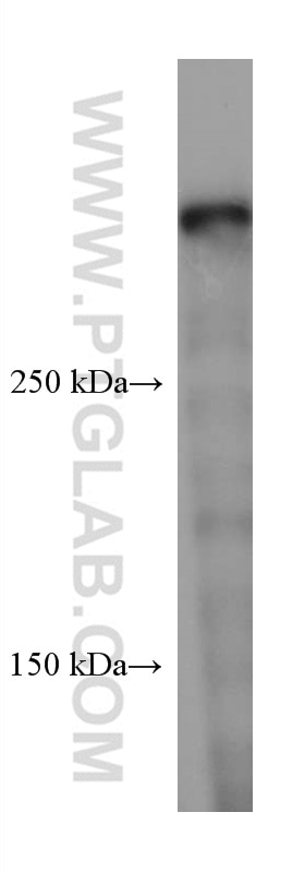 Western Blot (WB) analysis of rat brain tissue using DMXL2 Monoclonal antibody (66891-2-Ig)