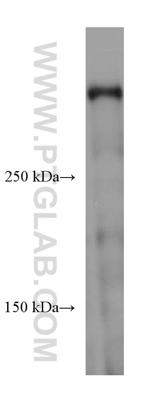 Western Blot (WB) analysis of mouse cerebellum tissue using DMXL2 Monoclonal antibody (66891-2-Ig)