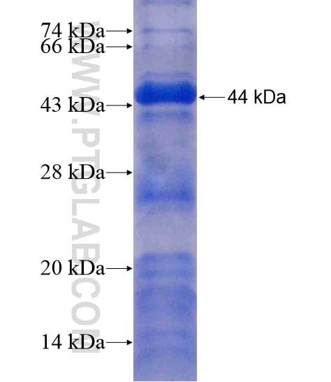 DMXL2 fusion protein Ag19861 SDS-PAGE