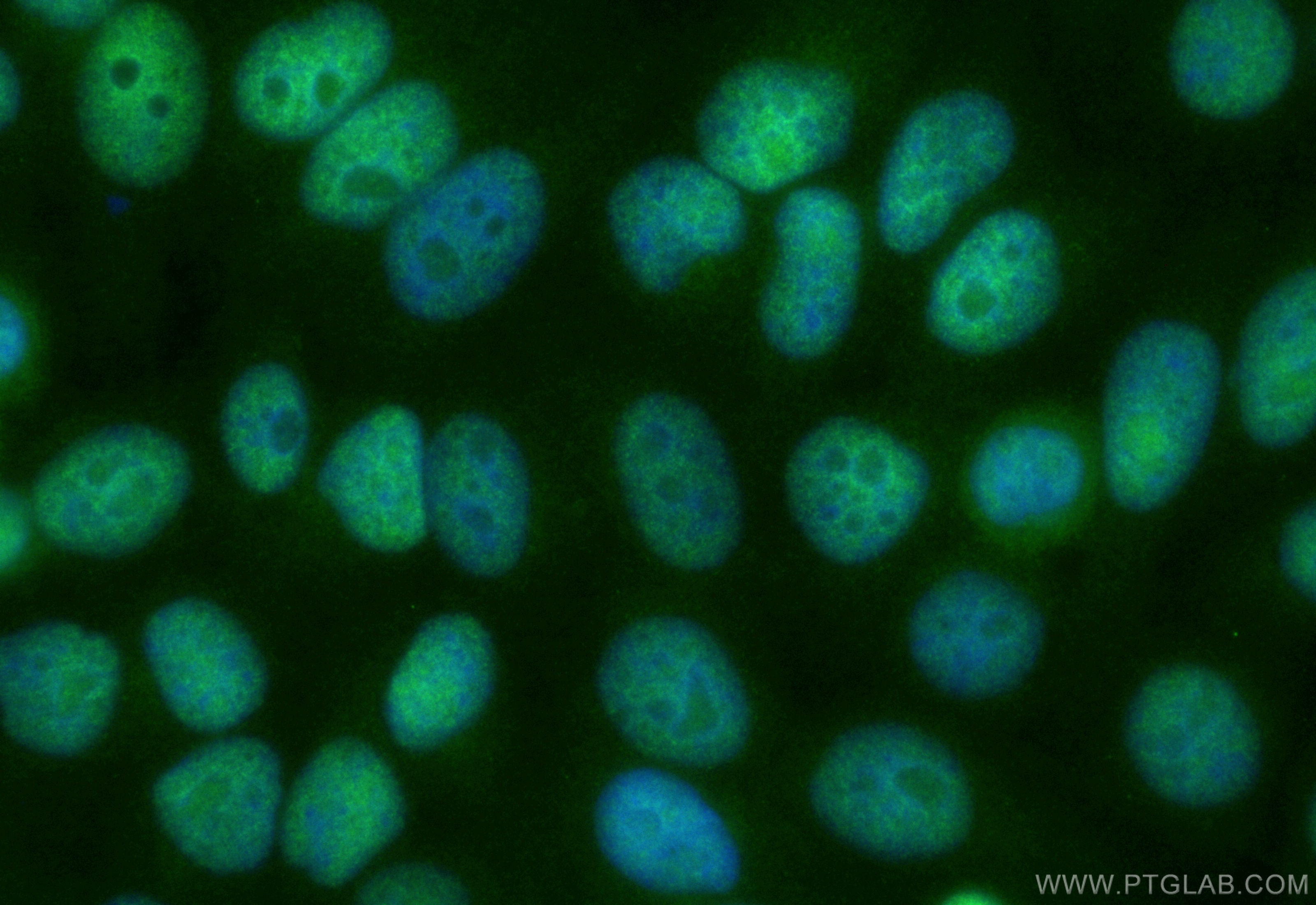 Immunofluorescence (IF) / fluorescent staining of HepG2 cells using CoraLite® Plus 488-conjugated DNA-PKcs Recombinant (CL488-85370-2)