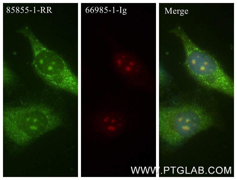 IF Staining of HeLa using 85855-1-RR Immunofluorescence (IF) / fluorescent staining of HeLa cells using DNA-RNA Hybrid Recombinant monoclonal antibody (85855-1-RR)