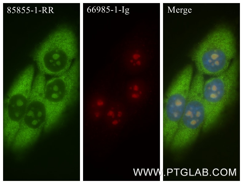 IF Staining of HepG2 using 85855-1-RR Immunofluorescence (IF) / fluorescent staining of HepG2 cells using DNA-RNA Hybrid Recombinant monoclonal antibody (85855-1-RR)