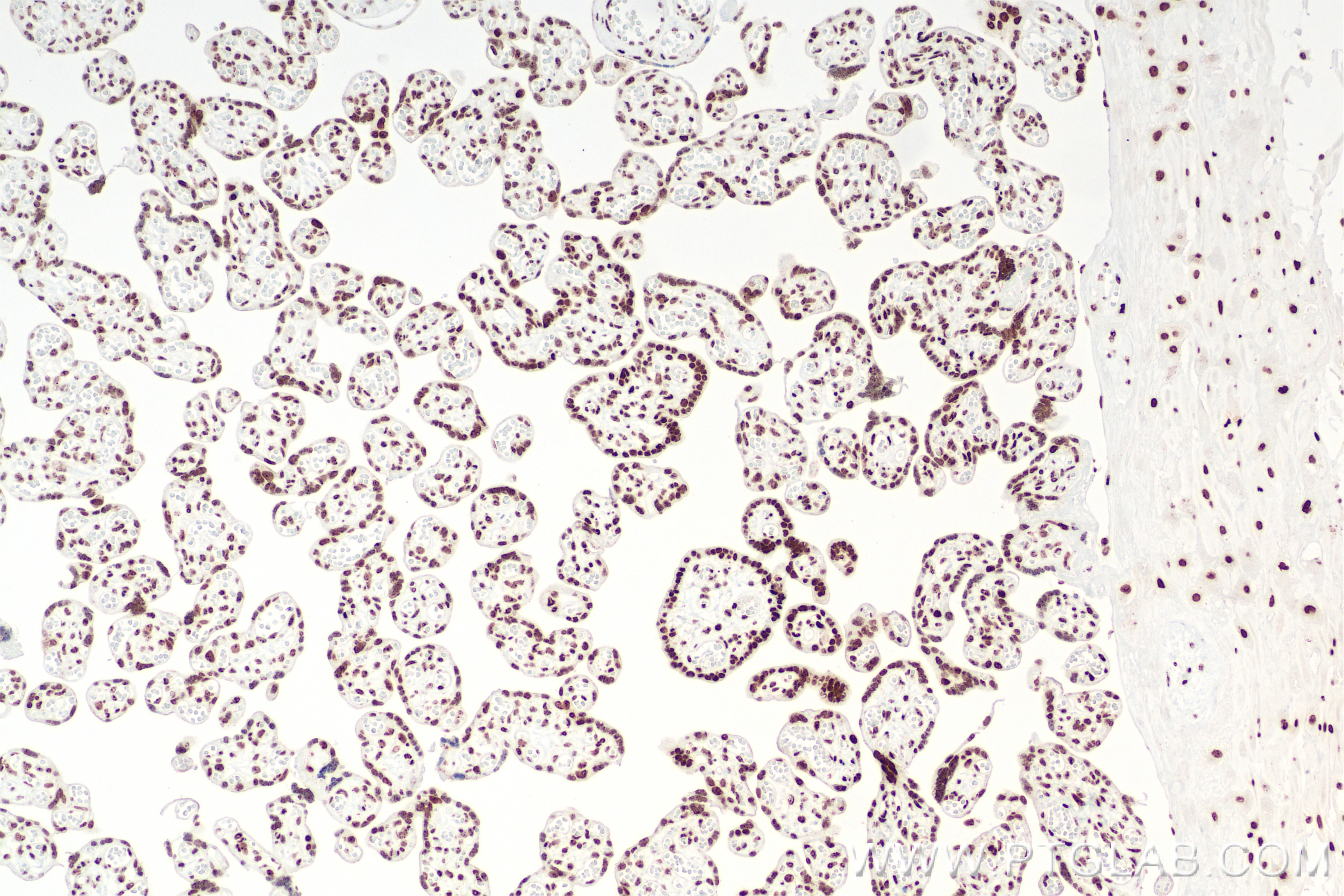 IHC staining of human placenta using 85855-1-RR Immunohistochemistry (IHC) staining of human placenta tissue using DNA-RNA Hybrid Recombinant monoclonal antibody (85855-1-RR)