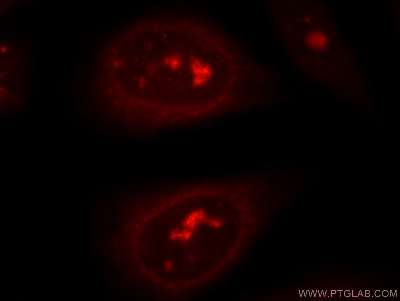Immunofluorescence (IF) / fluorescent staining of HepG2 cells using DNA2 Polyclonal antibody (18727-1-AP)