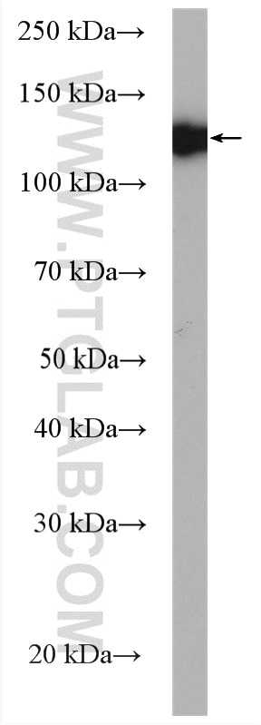 Western Blot (WB) analysis of mouse liver tissue using DNA2 Polyclonal antibody (18727-1-AP)