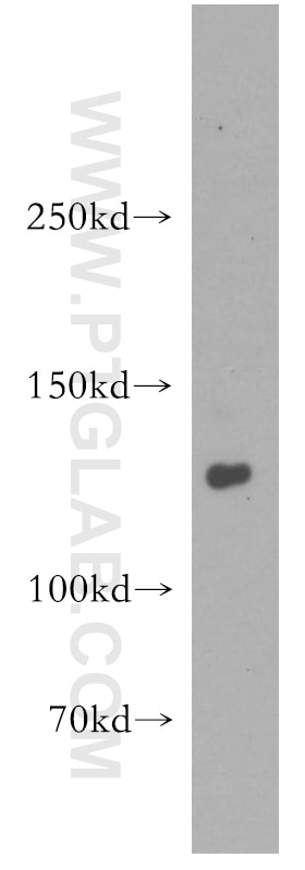 Western Blot (WB) analysis of mouse thymus tissue using DNA2 Polyclonal antibody (18727-1-AP)