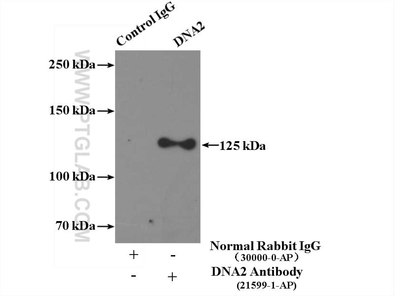 Immunoprecipitation (IP) experiment of HEK-293 cells using DNA2 Polyclonal antibody (21599-1-AP)