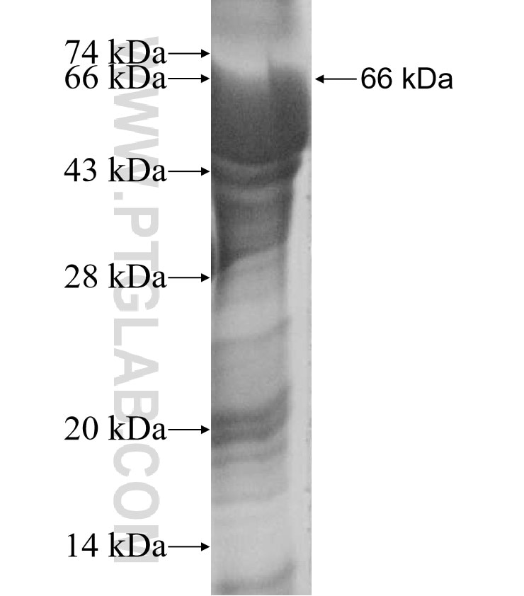 DNA2 fusion protein Ag16206 SDS-PAGE