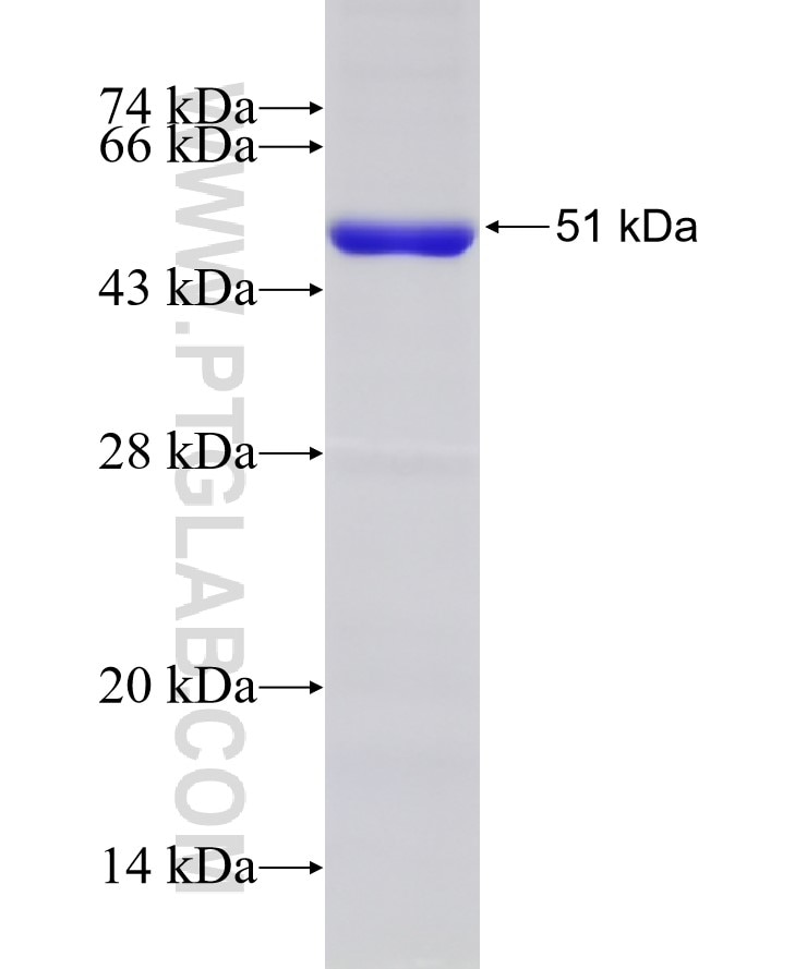 DNA2 fusion protein Ag17119 SDS-PAGE