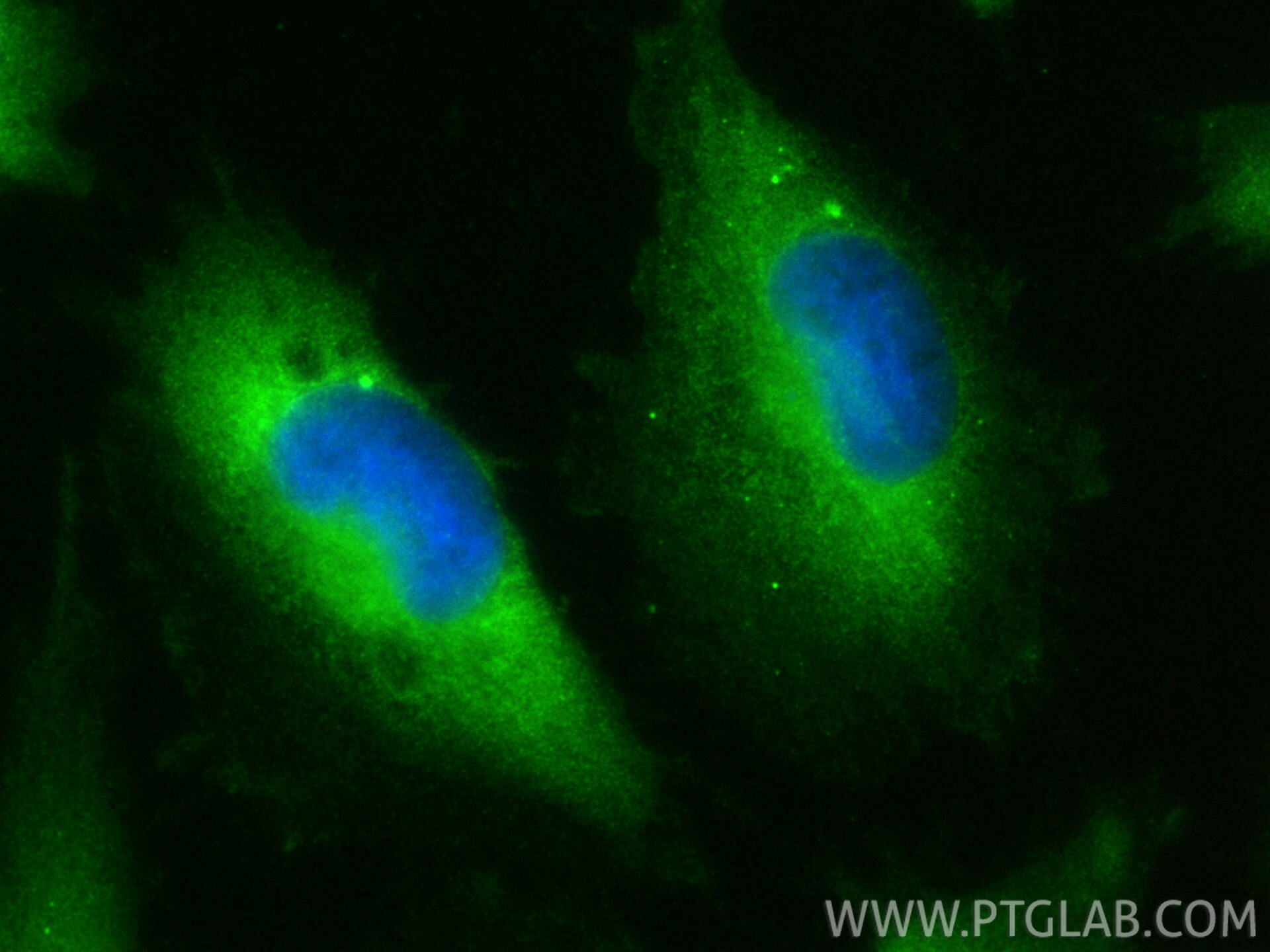 IF Staining of U-251 using 23228-1-AP (same clone as 23228-1-PBS) Immunofluorescence (IF) / fluorescent staining of U-251 cells using DNAAF2 Polyclonal antibody (23228-1-AP)