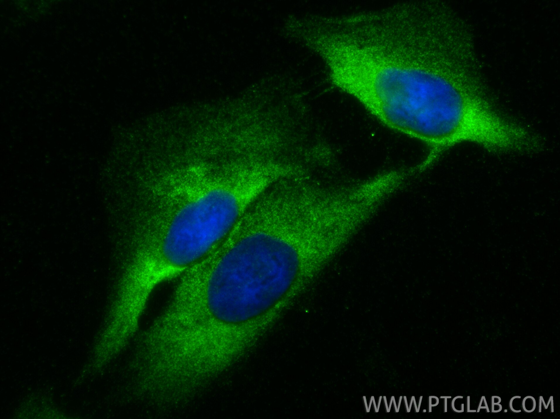 IF Staining of U2OS using 23228-1-AP (same clone as 23228-1-PBS) Immunofluorescence (IF) / fluorescent staining of U2OS cells using DNAAF2 Polyclonal antibody (23228-1-AP)