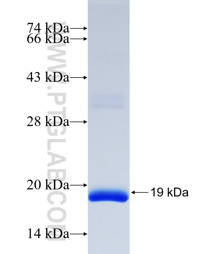 DNAH10 fusion protein Ag37015 SDS-PAGE DNAH10 fusion protein Ag37015 SDS-PAGE
