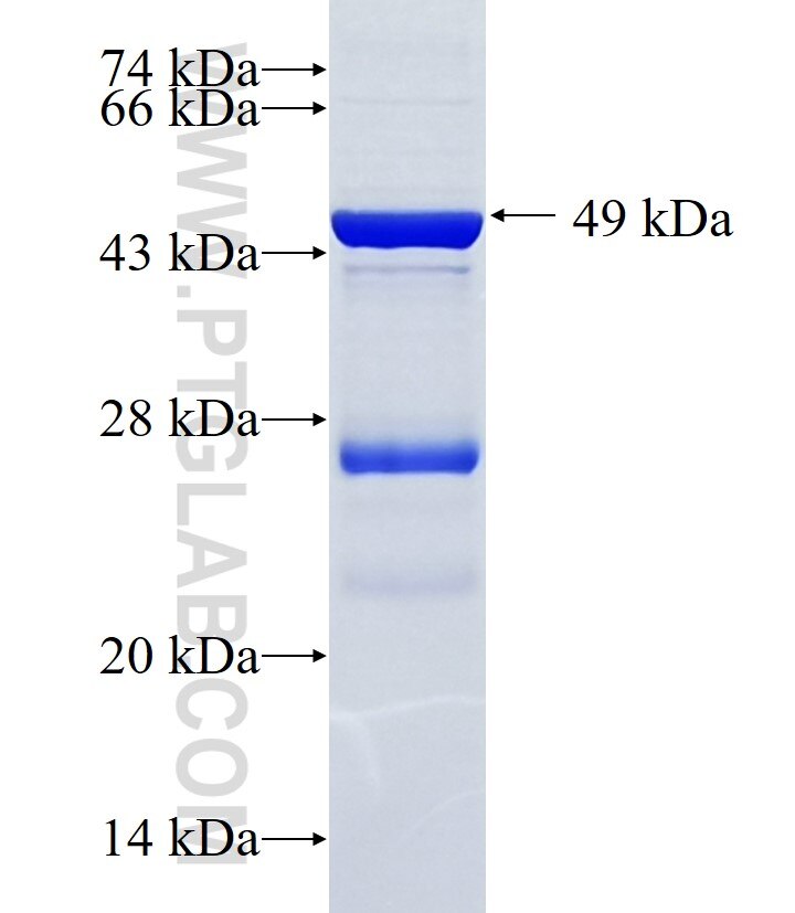 DNAH11 fusion protein Ag34658 SDS-PAGE