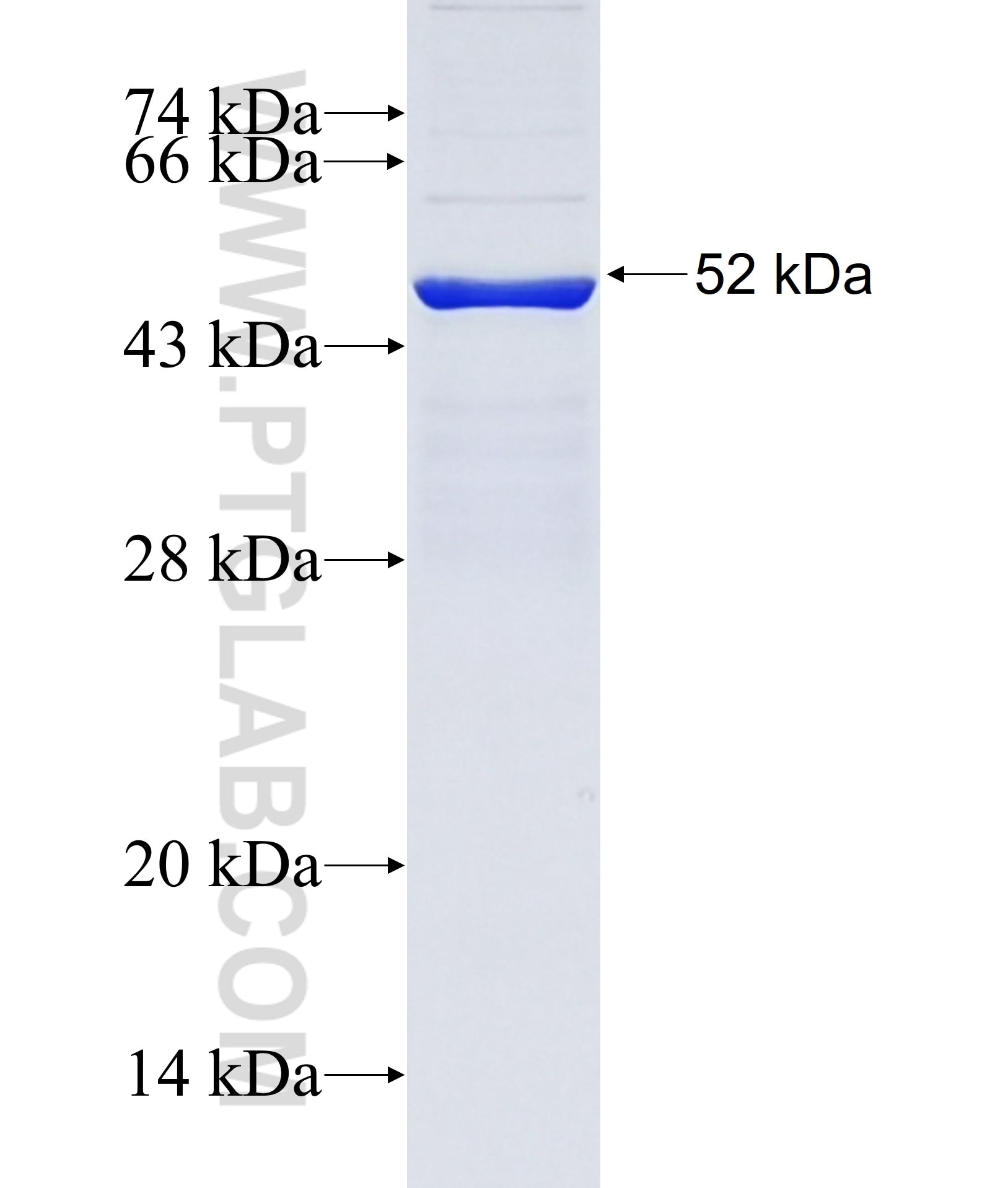 DNAH12 fusion protein Ag38008 SDS-PAGE