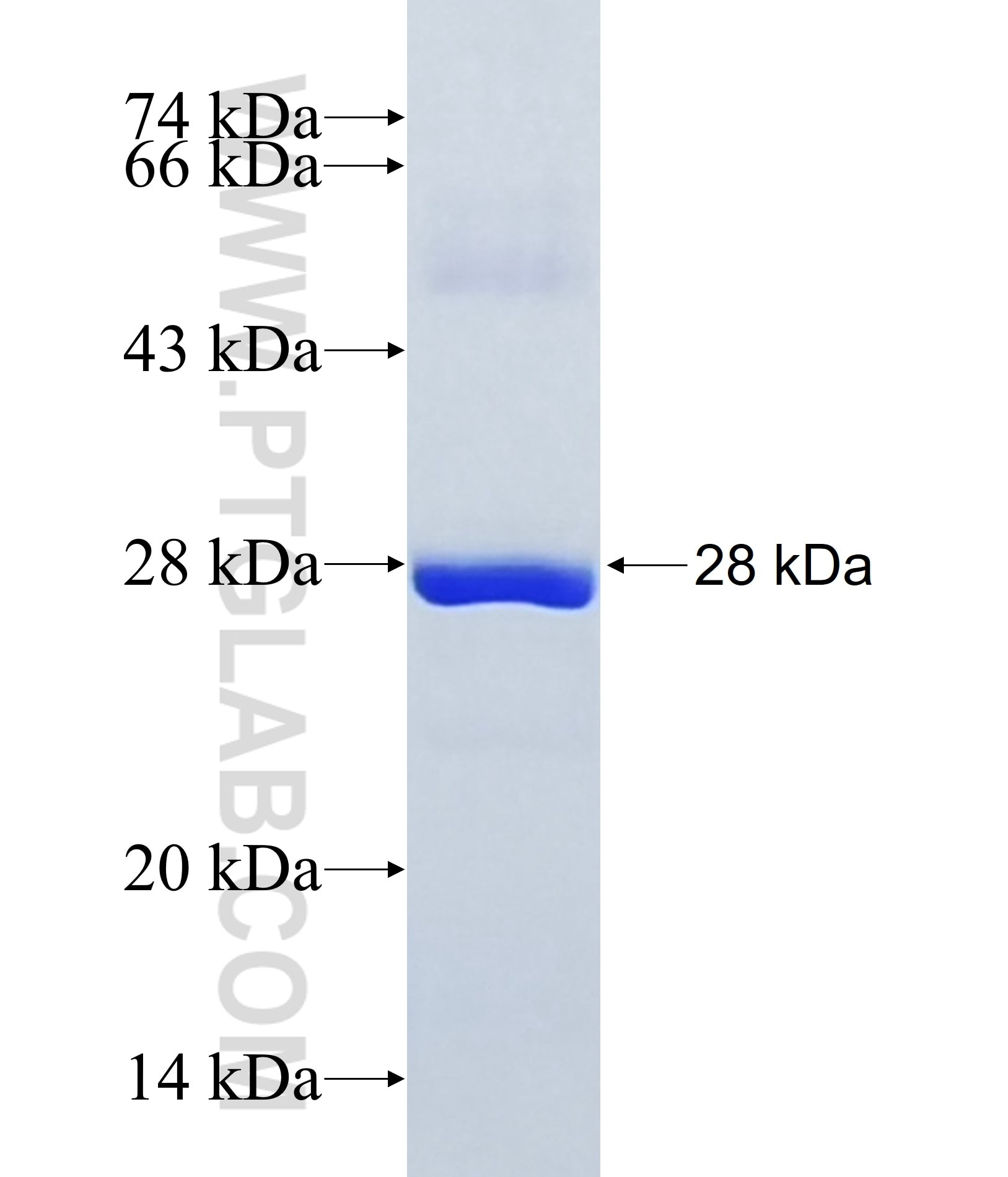 DNAH12 fusion protein Ag38033 SDS-PAGE DNAH12 fusion protein Ag38033 SDS-PAGE