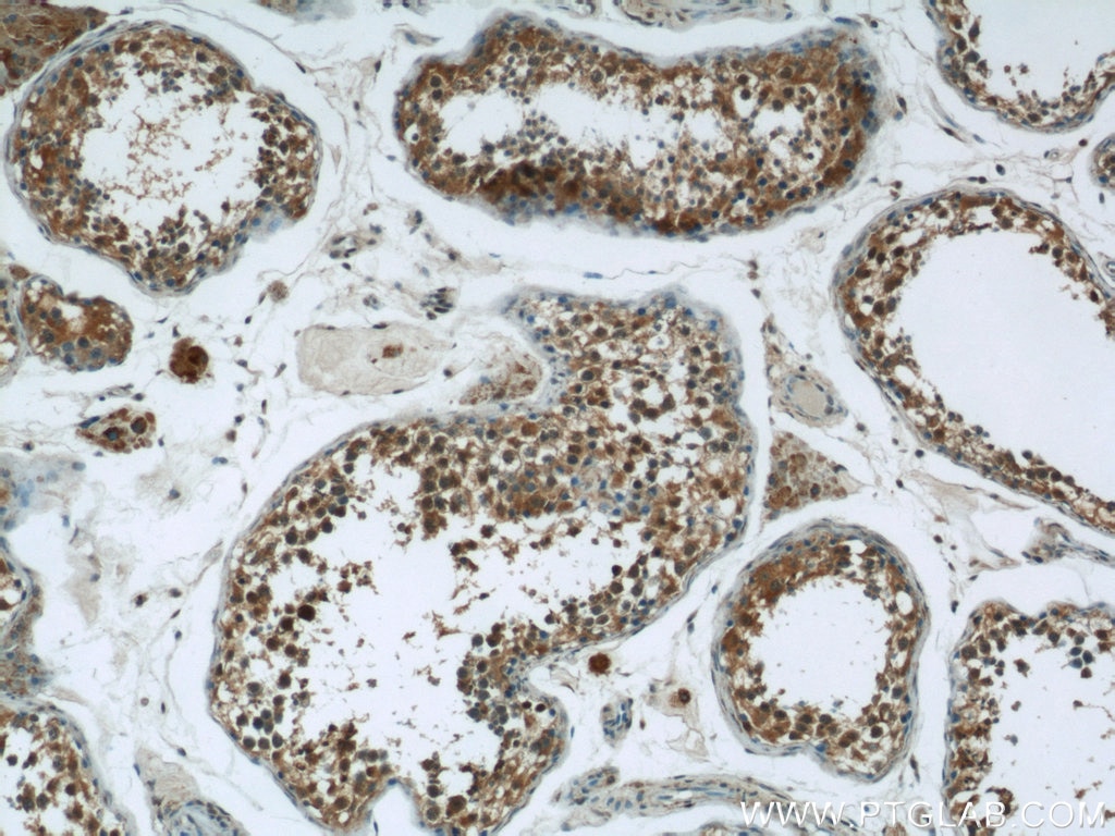 Immunohistochemistry (IHC) staining of human testis tissue using DNAH14 Polyclonal antibody (25072-1-AP)