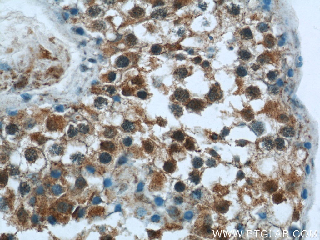 Immunohistochemistry (IHC) staining of human testis tissue using DNAH14 Polyclonal antibody (25072-1-AP)