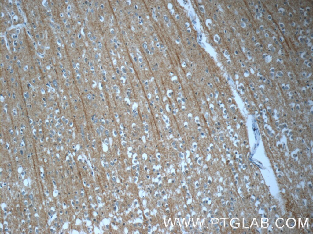 Immunohistochemistry (IHC) staining of human brain tissue using DNAH14 Polyclonal antibody (25072-1-AP)