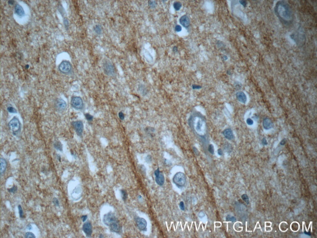 Immunohistochemistry (IHC) staining of human brain tissue using DNAH14 Polyclonal antibody (25072-1-AP)