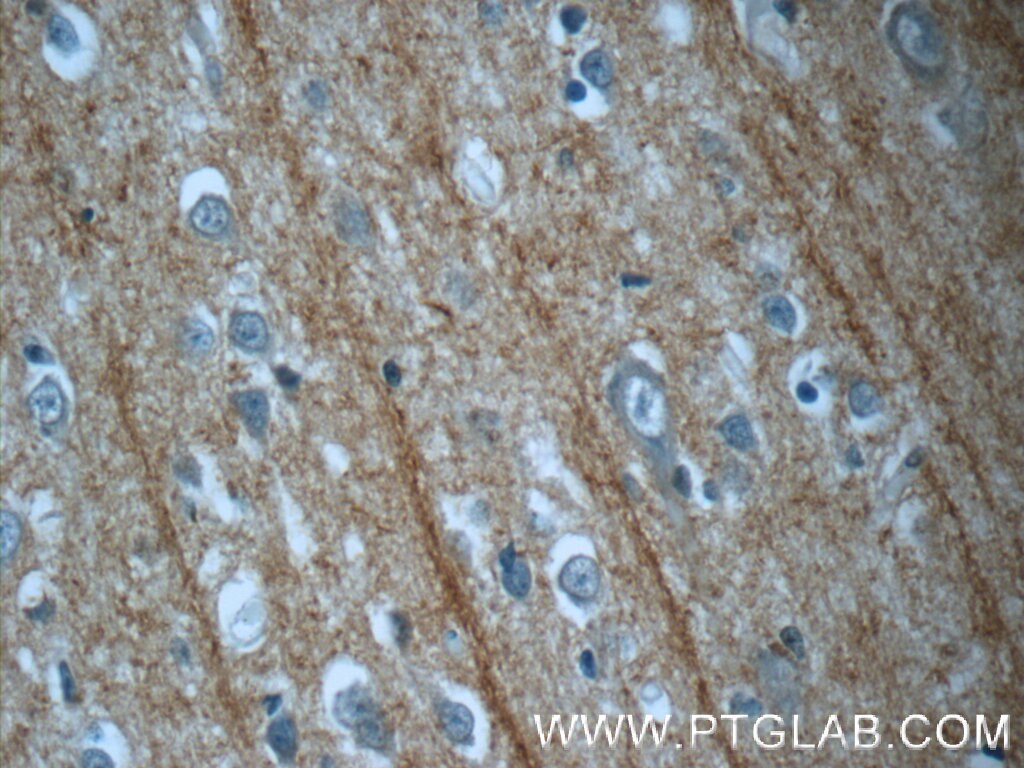 Immunohistochemistry (IHC) staining of human brain tissue using DNAH14 Polyclonal antibody (25072-1-AP)