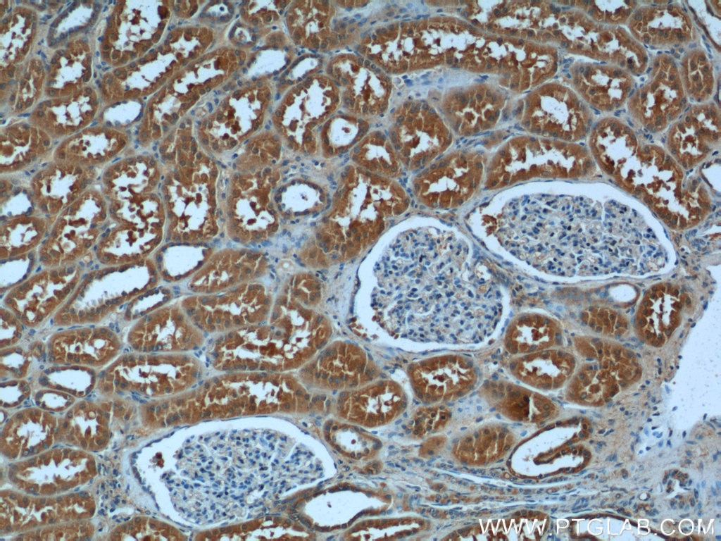 Immunohistochemistry (IHC) staining of human kidney tissue using DNAH17 Polyclonal antibody (24488-1-AP)
