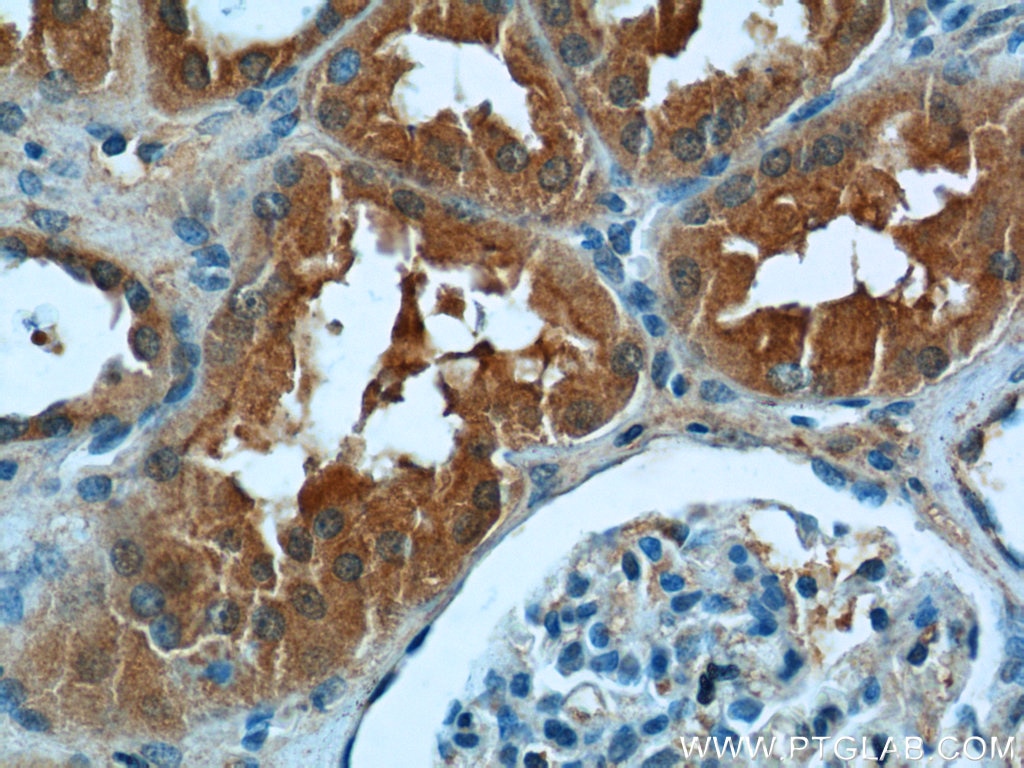 Immunohistochemistry (IHC) staining of human kidney tissue using DNAH17 Polyclonal antibody (24488-1-AP)