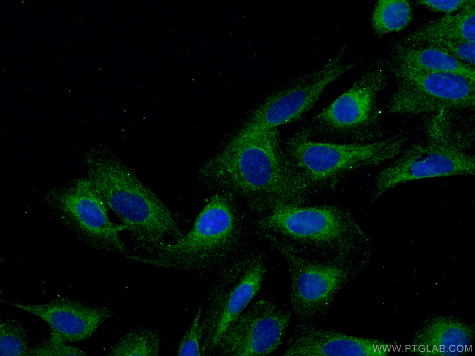 Immunofluorescence (IF) / fluorescent staining of U2OS cells using DNAH2 Polyclonal antibody (18841-1-AP)