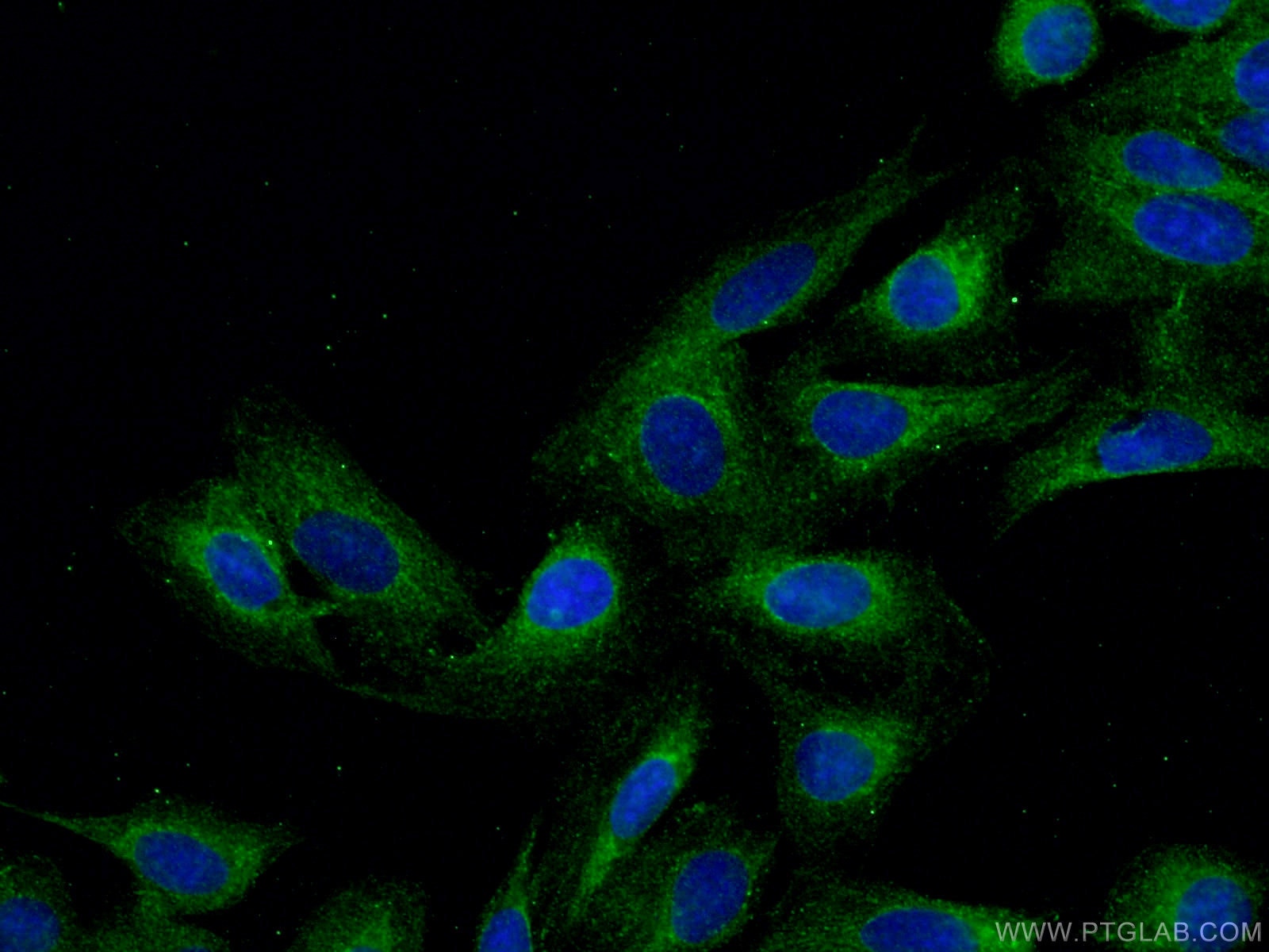 IF Staining of U2OS using 18841-1-AP