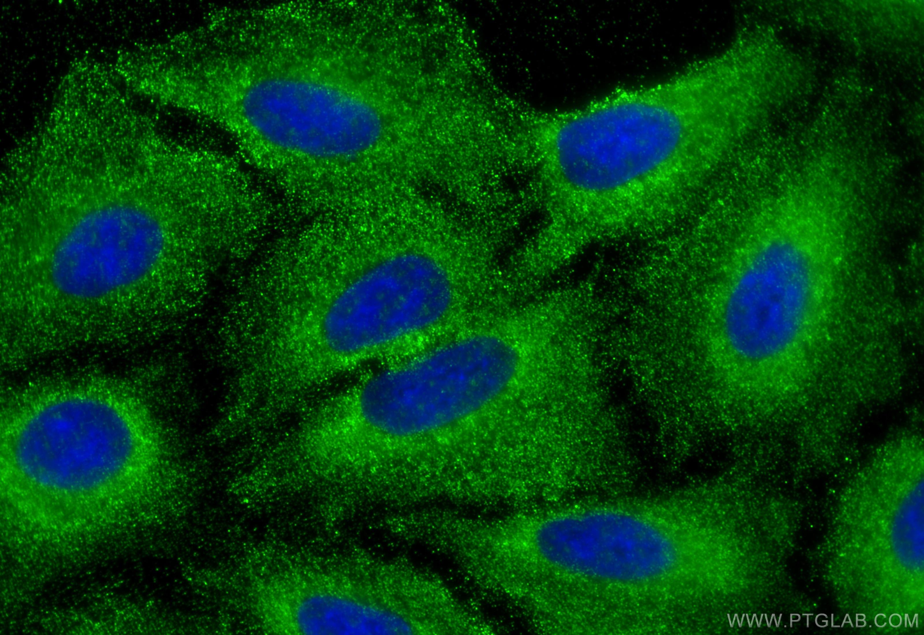 Immunofluorescence (IF) / fluorescent staining of A549 cells using DNAH2 Polyclonal antibody (18841-1-AP)