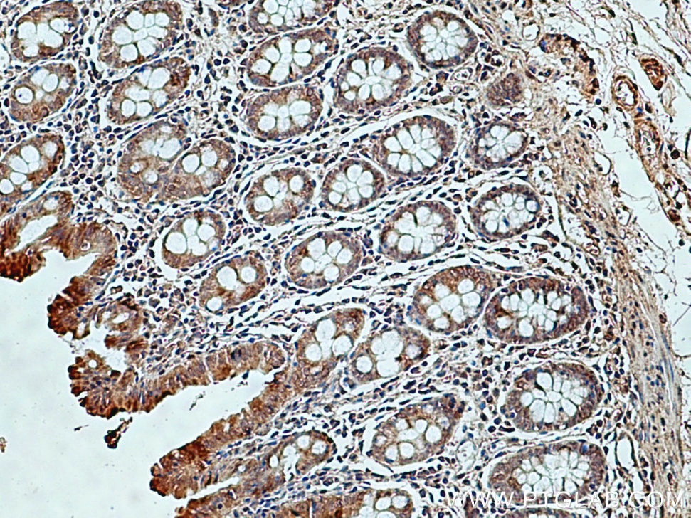 Immunohistochemistry (IHC) staining of human colon tissue using DNAH2 Polyclonal antibody (18841-1-AP)