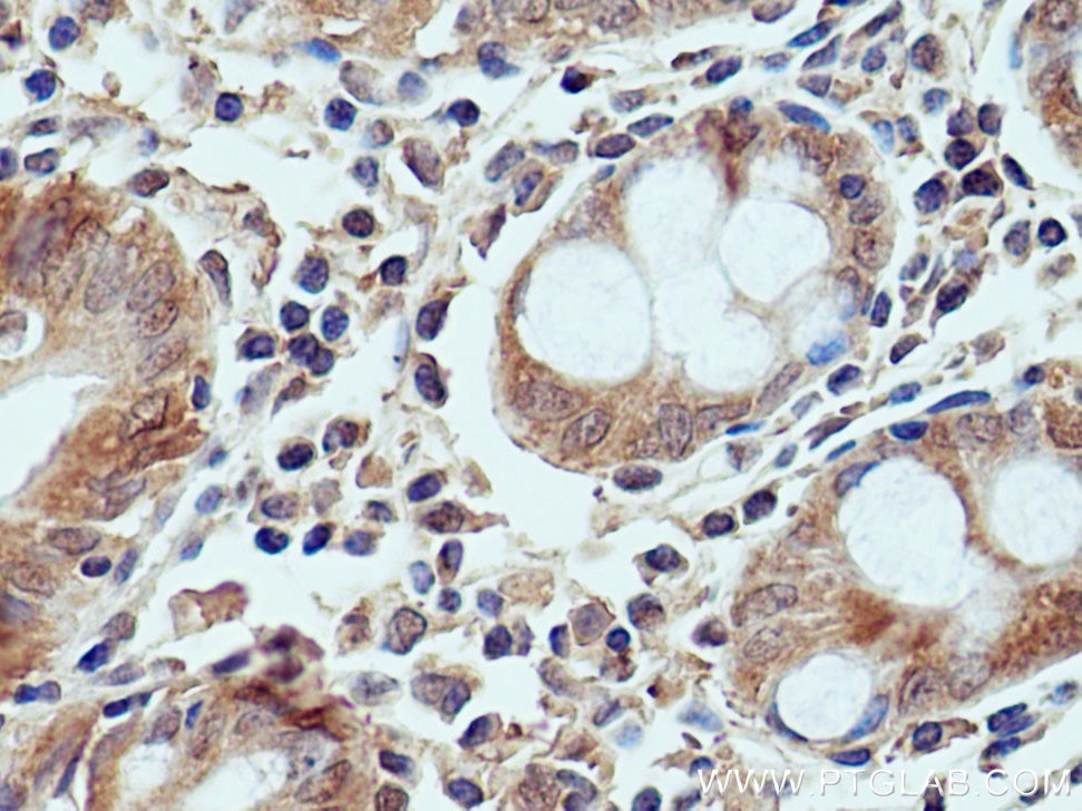 Immunohistochemistry (IHC) staining of human colon tissue using DNAH2 Polyclonal antibody (18841-1-AP)