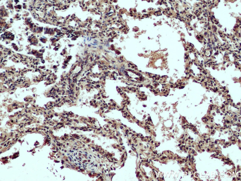 Immunohistochemistry (IHC) staining of human lung tissue using DNAH2 Polyclonal antibody (18841-1-AP)