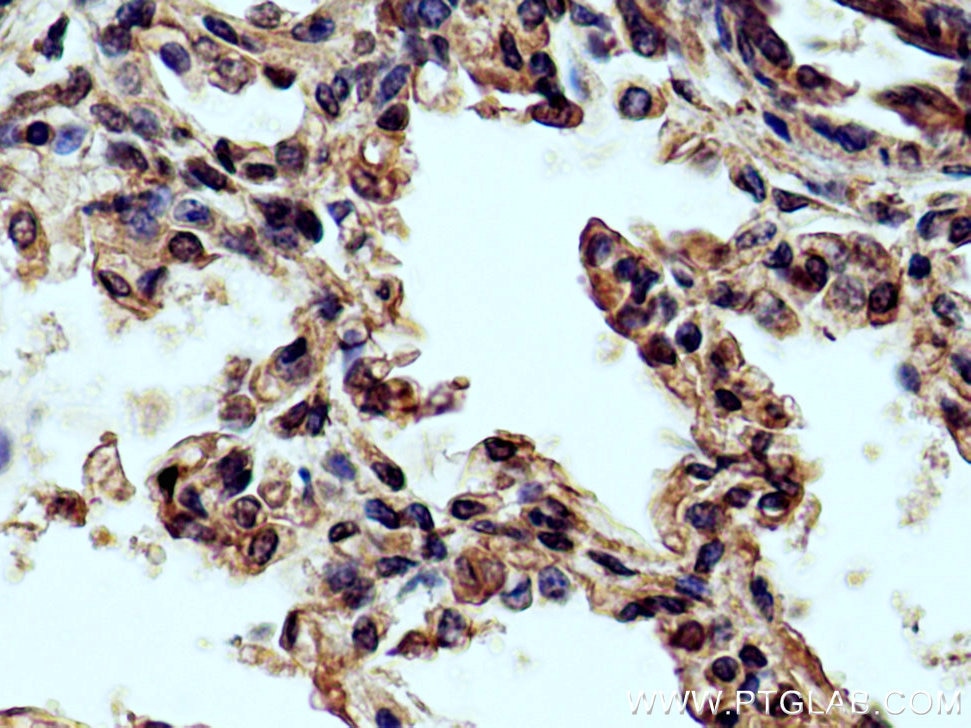 Immunohistochemistry (IHC) staining of human lung tissue using DNAH2 Polyclonal antibody (18841-1-AP)