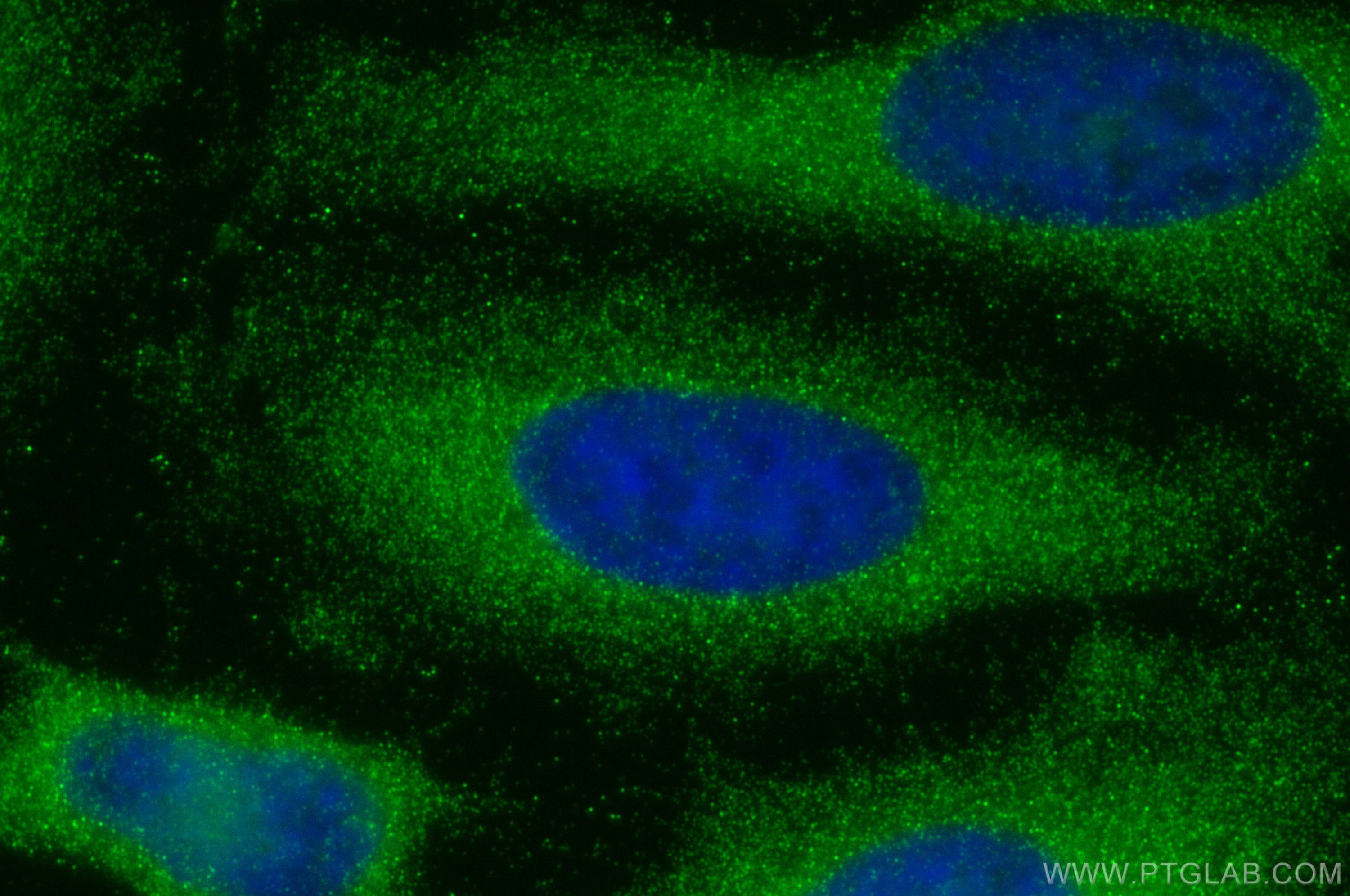 Immunofluorescence (IF) / fluorescent staining of HeLa cells using DNAH5 Polyclonal antibody (31079-1-AP)