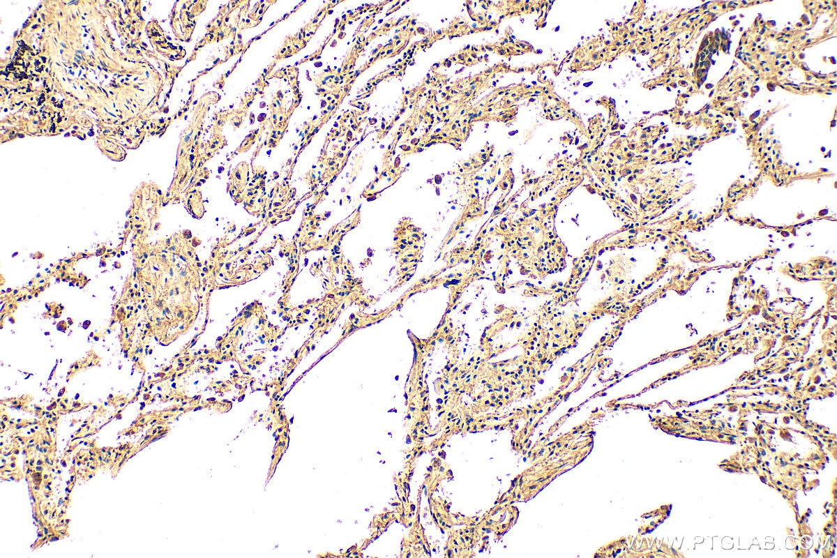 Immunohistochemistry (IHC) staining of human lung tissue using DNAH5 Polyclonal antibody (31079-1-AP)