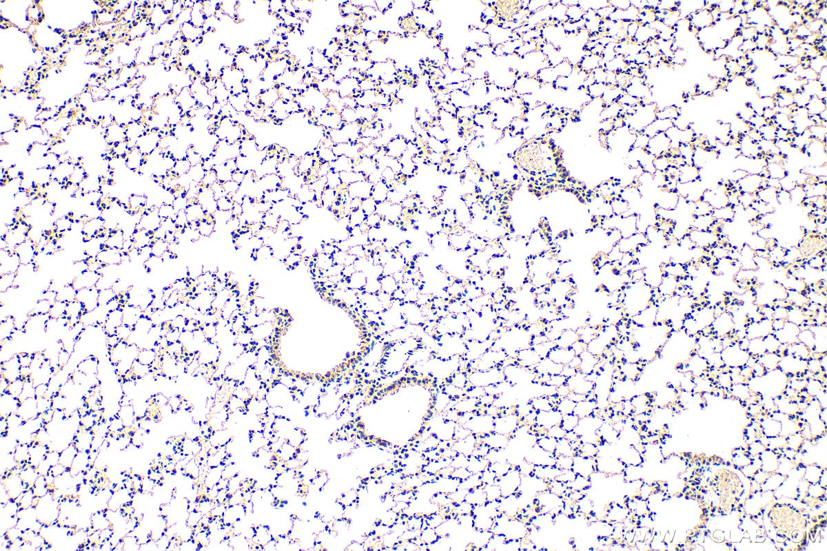 Immunohistochemistry (IHC) staining of mouse lung tissue using DNAH5 Polyclonal antibody (31079-1-AP)
