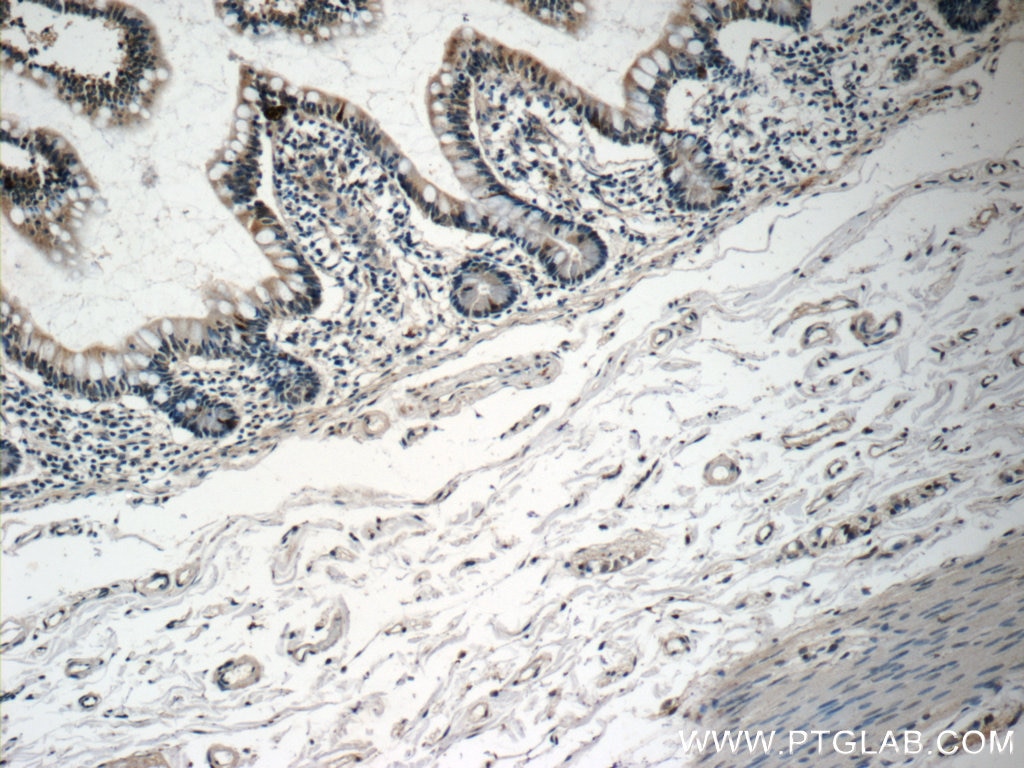 Immunohistochemistry (IHC) staining of human small intestine tissue using DNAH6 Polyclonal antibody (18080-1-AP)