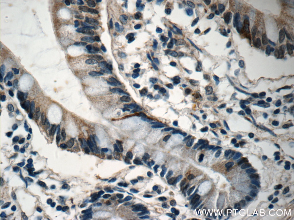 Immunohistochemistry (IHC) staining of human small intestine tissue using DNAH6 Polyclonal antibody (18080-1-AP)