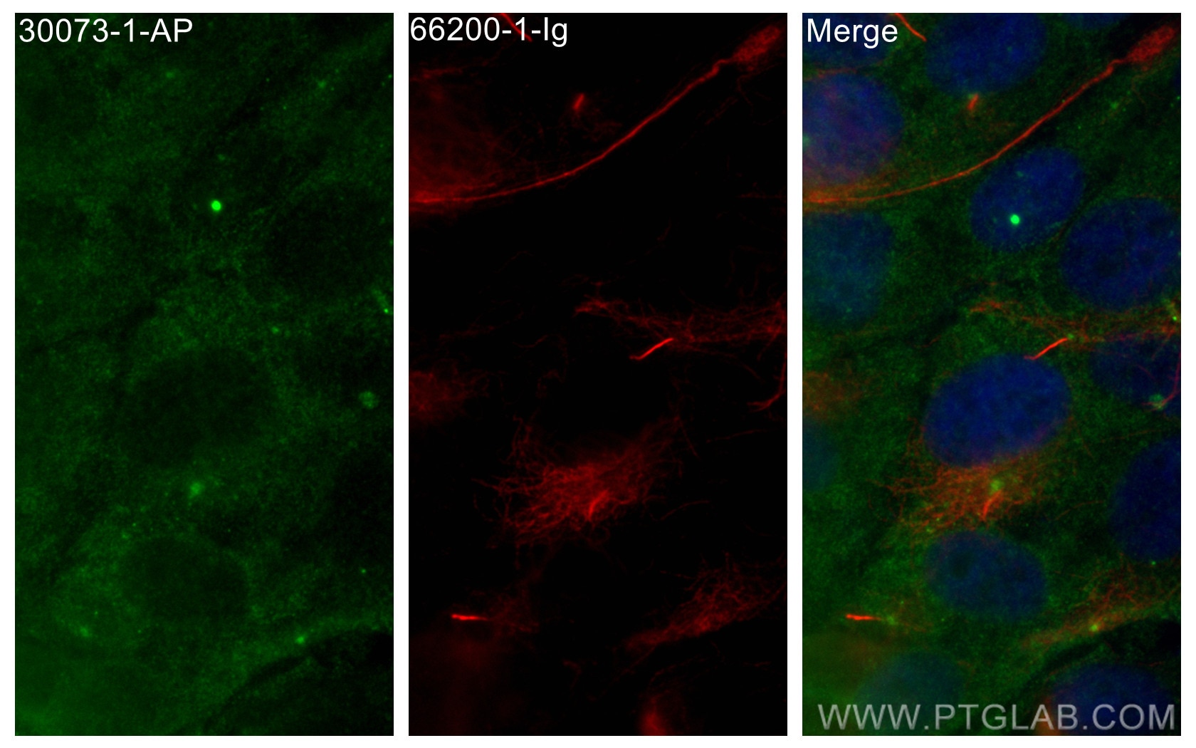 Immunofluorescence (IF) / fluorescent staining of hTERT-RPE1 cells using DNAH6 Polyclonal antibody (30073-1-AP)
