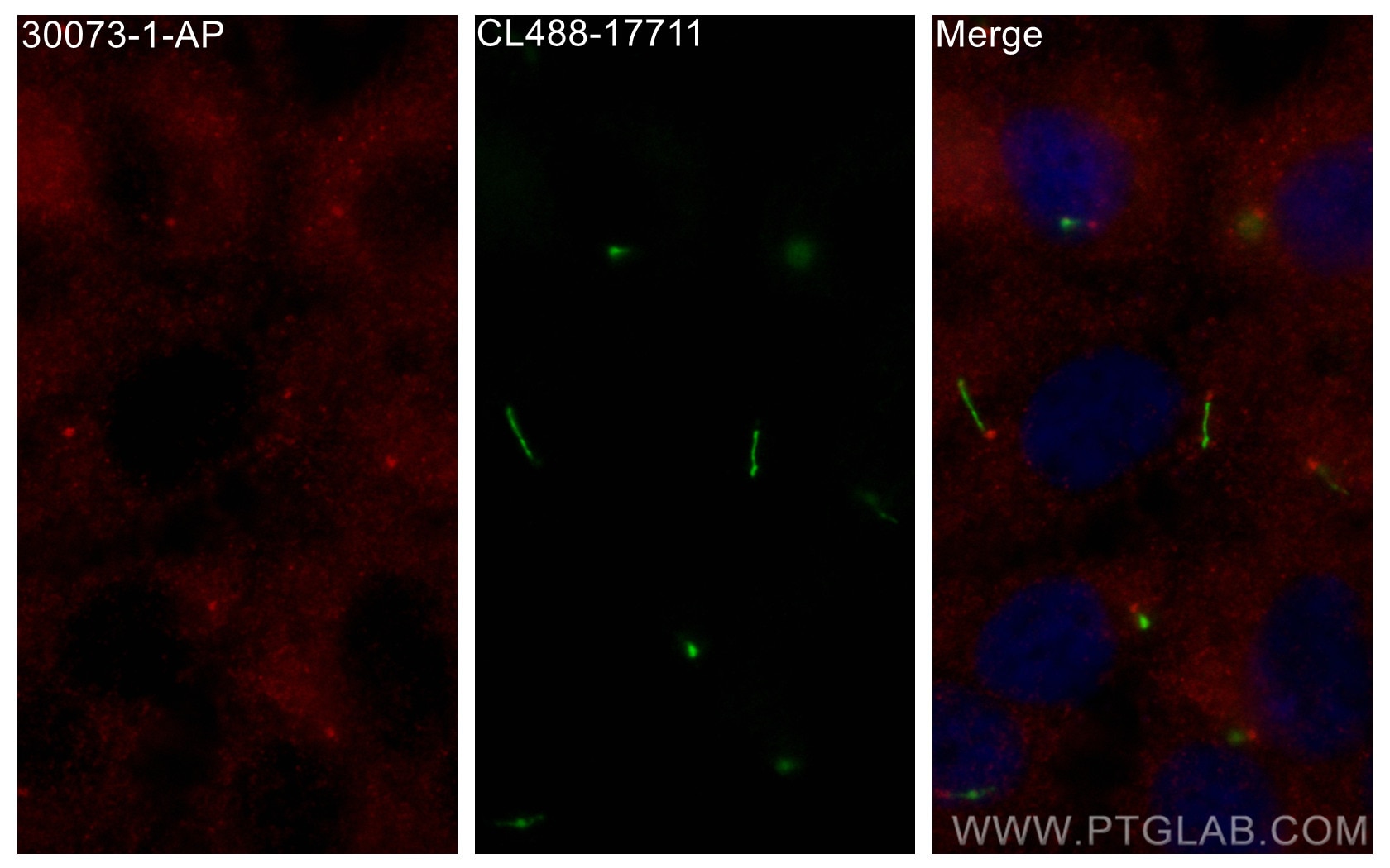 Immunofluorescence (IF) / fluorescent staining of hTERT-RPE1 cells using DNAH6 Polyclonal antibody (30073-1-AP)