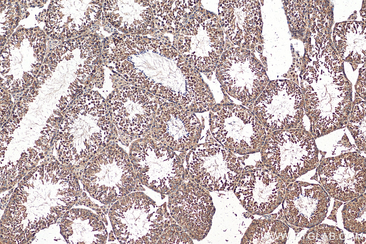 Immunohistochemistry (IHC) staining of mouse testis tissue using DNAH6 Polyclonal antibody (30073-1-AP)