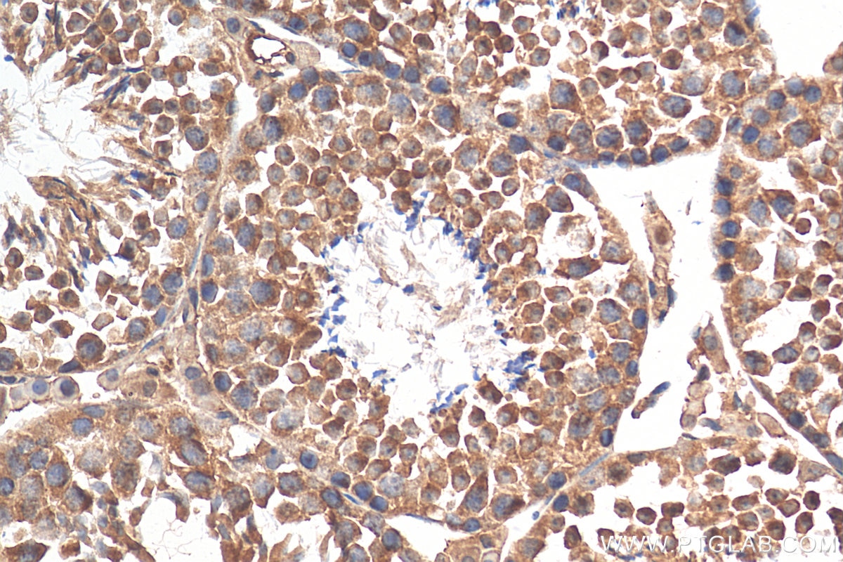 Immunohistochemistry (IHC) staining of mouse testis tissue using DNAH6 Polyclonal antibody (30073-1-AP)