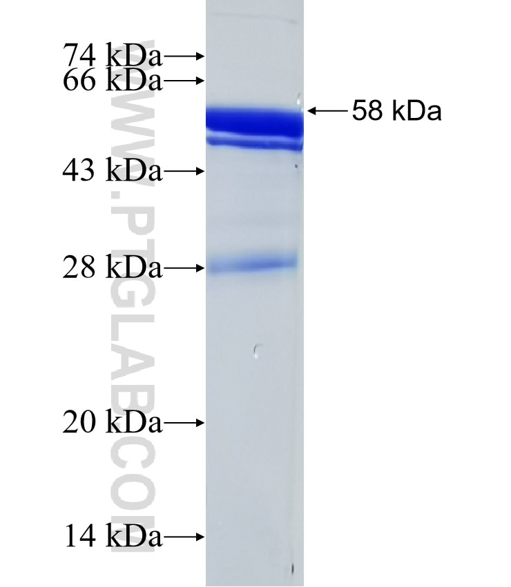 DNAH6 fusion protein Ag32364 SDS-PAGE