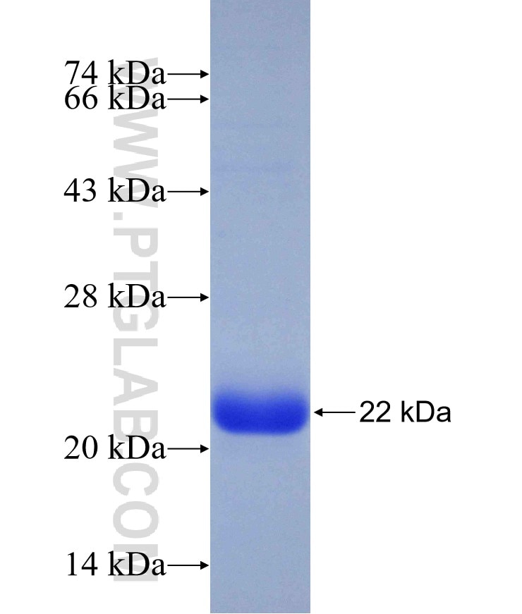 DNAH8 fusion protein Ag29959 SDS-PAGE