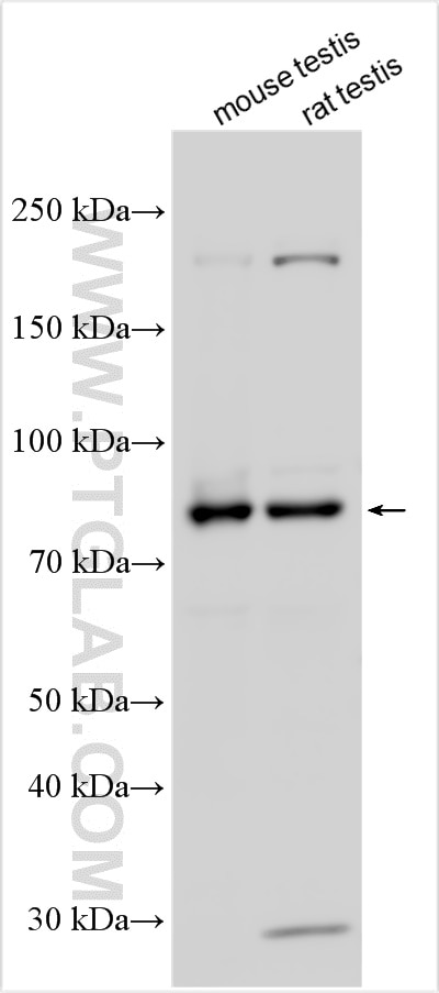 Western Blot (WB) analysis of various lysates using DNAI1 Polyclonal antibody (12756-1-AP)